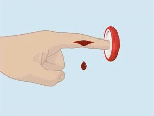 Step 1: Sliding the T-Ring onto the injured finger effortlessly, with no twisting, tying, or adjusting required.
