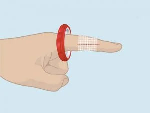 Step 3: Allowing the T-Ring to temporarily restrict blood flow, giving medical professionals or first aid responders time to clean and treat the wound.