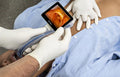 Ambu SureSight Mobile Video Laryngoscope: Video Airway Management Built for EMS and Fire