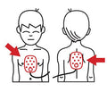 Placement of AED Pads on Infants