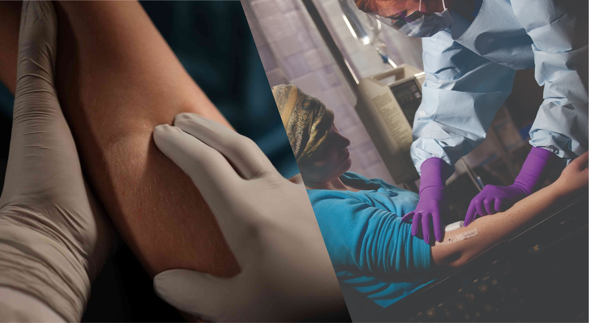 medical grade nitrile latex exam gloves comparison