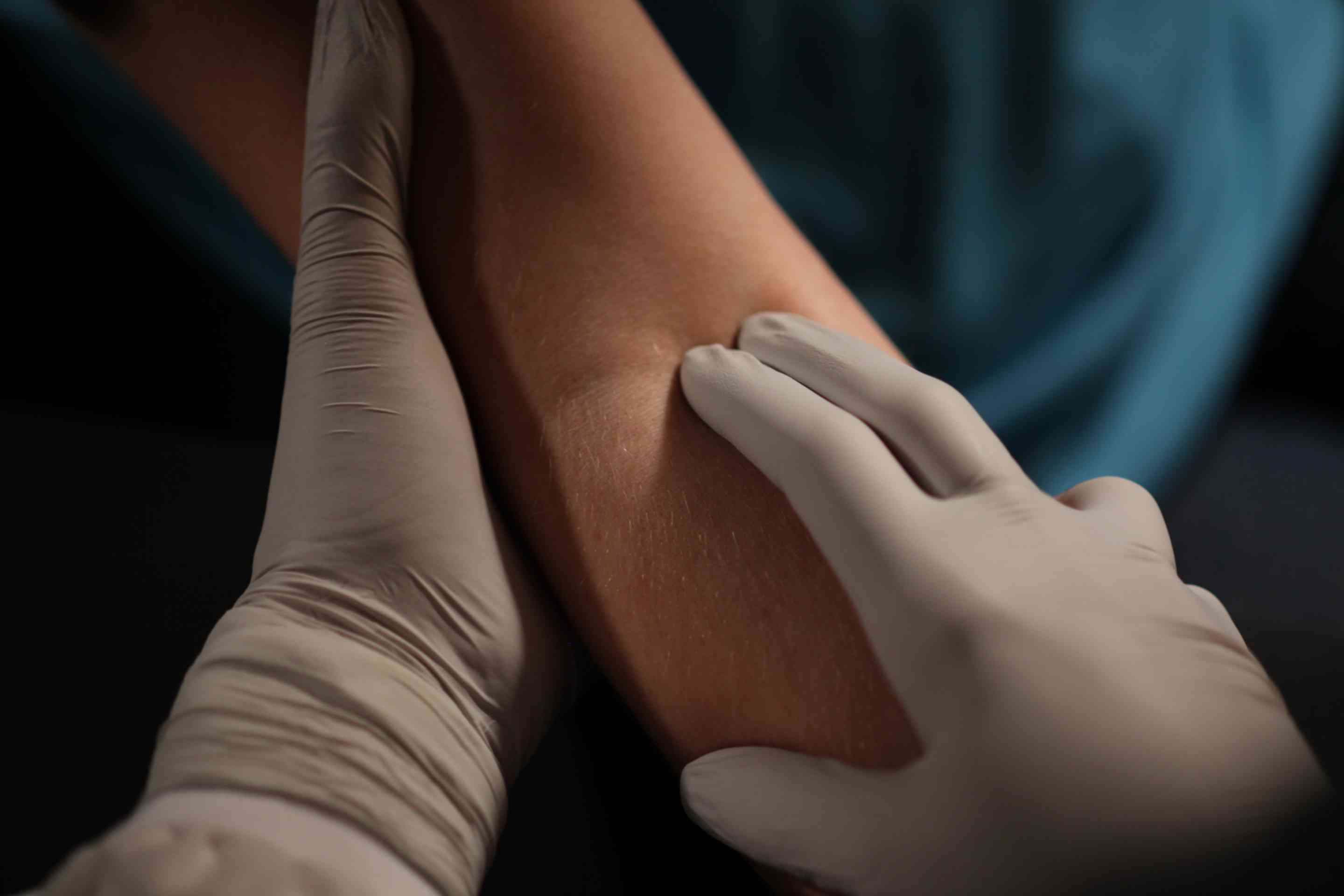 sterling-nitrile-exam-gloves