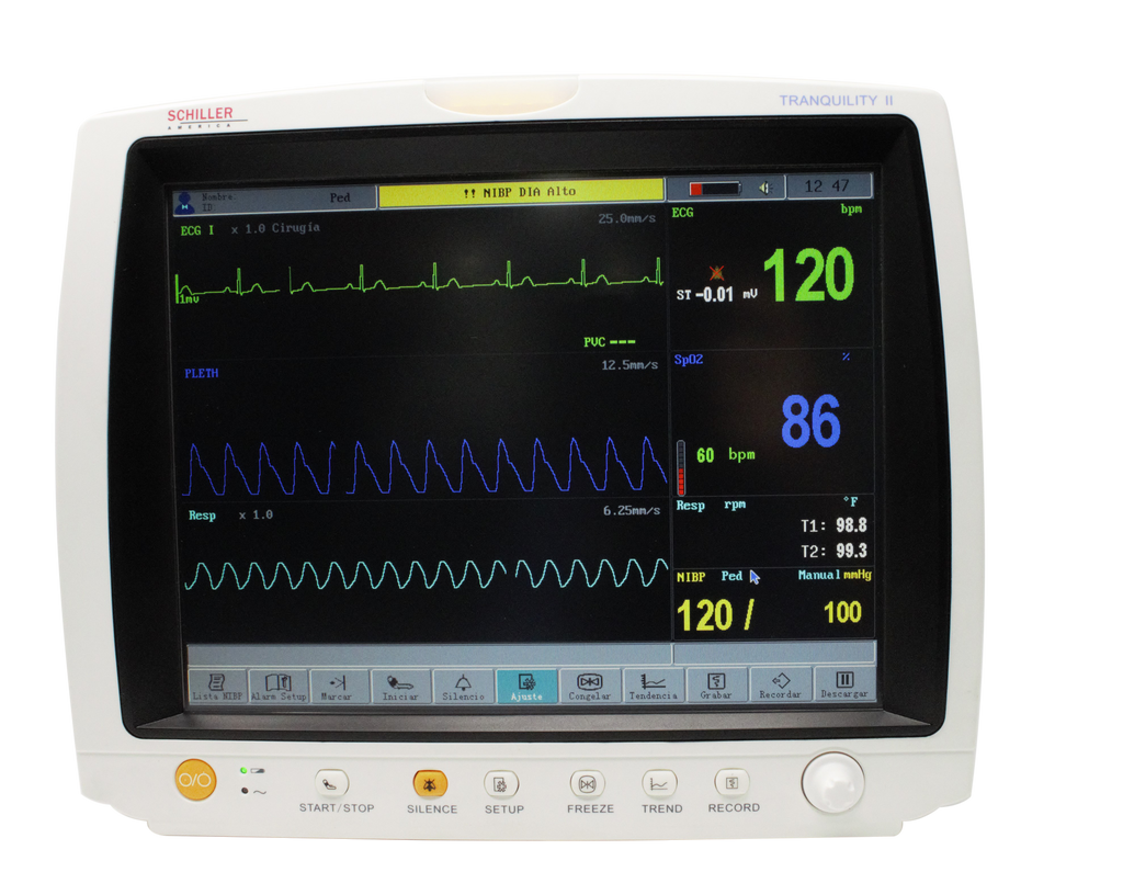 Schiller Tranquility II showing ECG, SPO2, and more